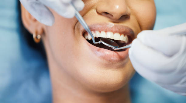 Best Emergency Root Canal Treatment in Washburn, ND
