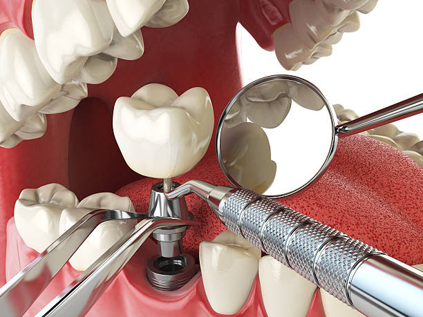 Professional Emergency Dentist in ND